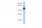 GLUD1 antibody - N-terminal region
